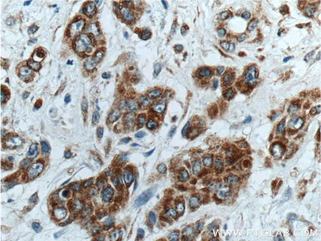 TSFM Antibody in Immunohistochemistry (Paraffin) (IHC (P))
