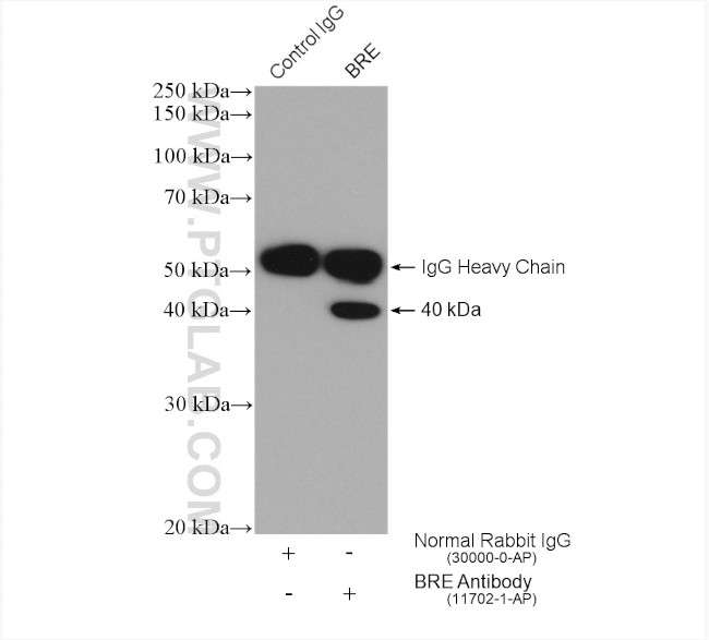 BRE Antibody in Immunoprecipitation (IP)