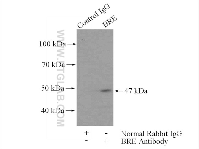 BRE Antibody in Immunoprecipitation (IP)