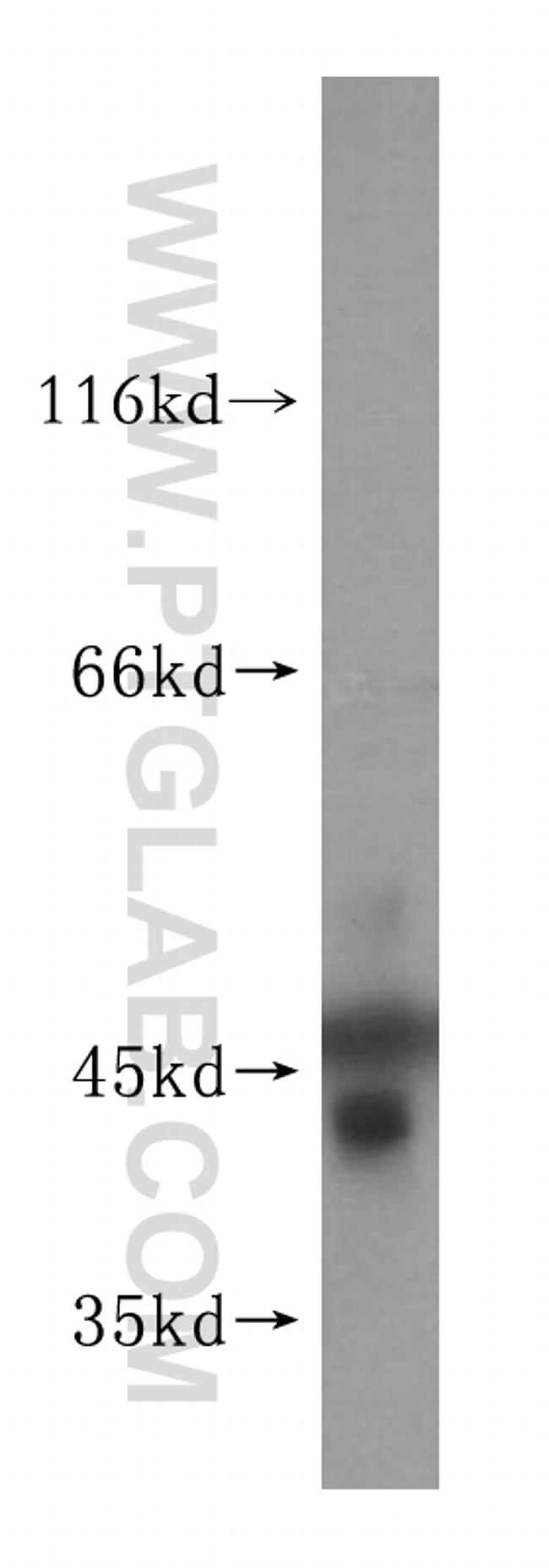 BRE Antibody in Western Blot (WB)