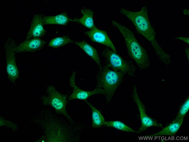 CDK9 Antibody in Immunocytochemistry (ICC/IF)