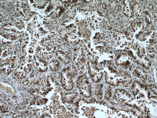 CDK9 Antibody in Immunohistochemistry (Paraffin) (IHC (P))