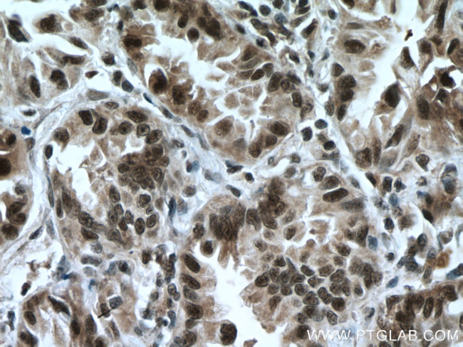 CDK9 Antibody in Immunohistochemistry (Paraffin) (IHC (P))