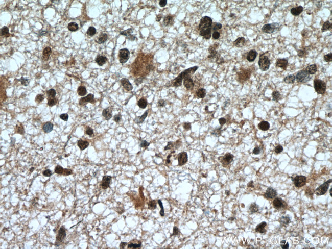 CDK9 Antibody in Immunohistochemistry (Paraffin) (IHC (P))