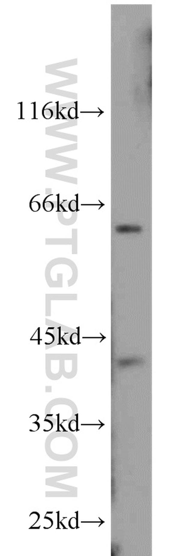 CDK9 Antibody in Western Blot (WB)