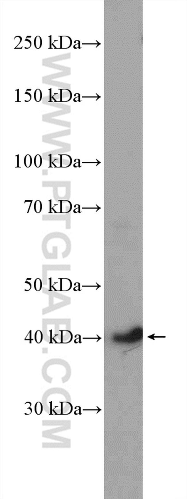 CDK9 Antibody in Western Blot (WB)