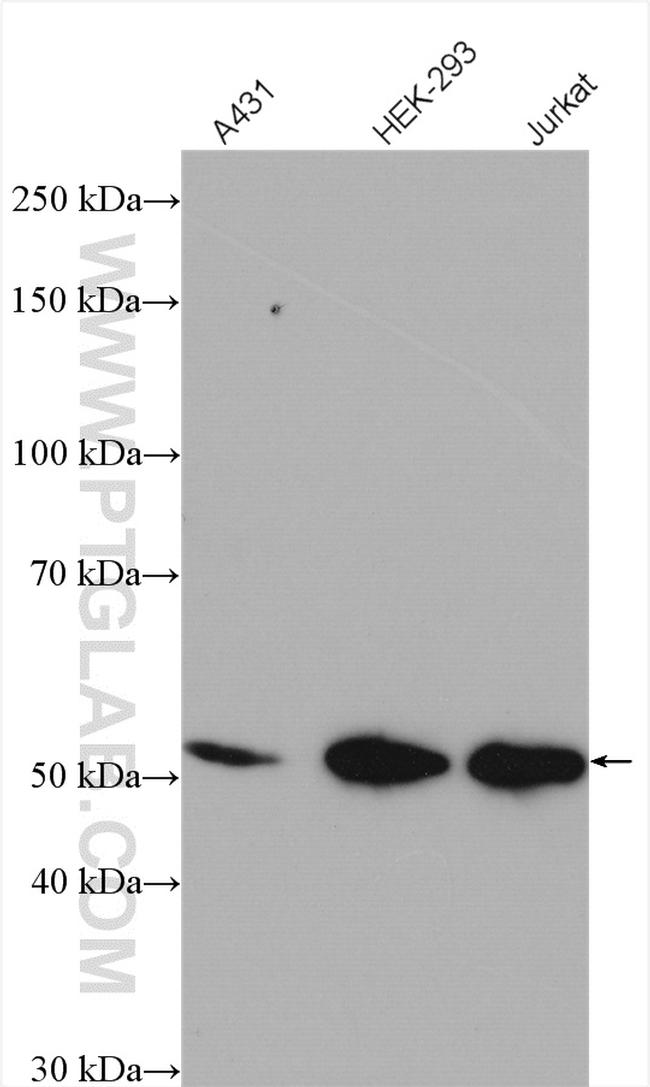 CDK9 Antibody in Western Blot (WB)