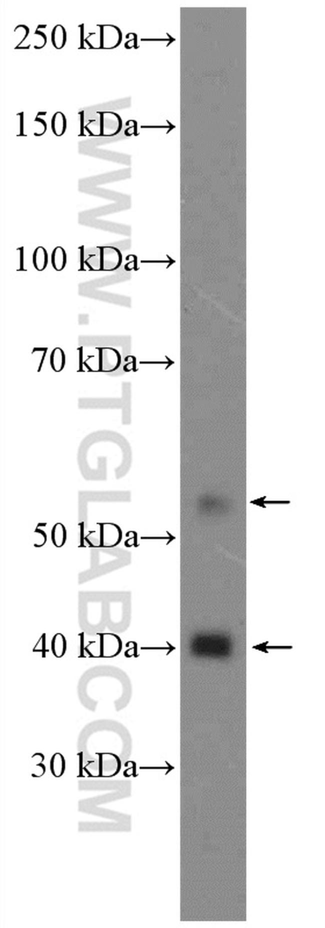 CDK9 Antibody in Western Blot (WB)