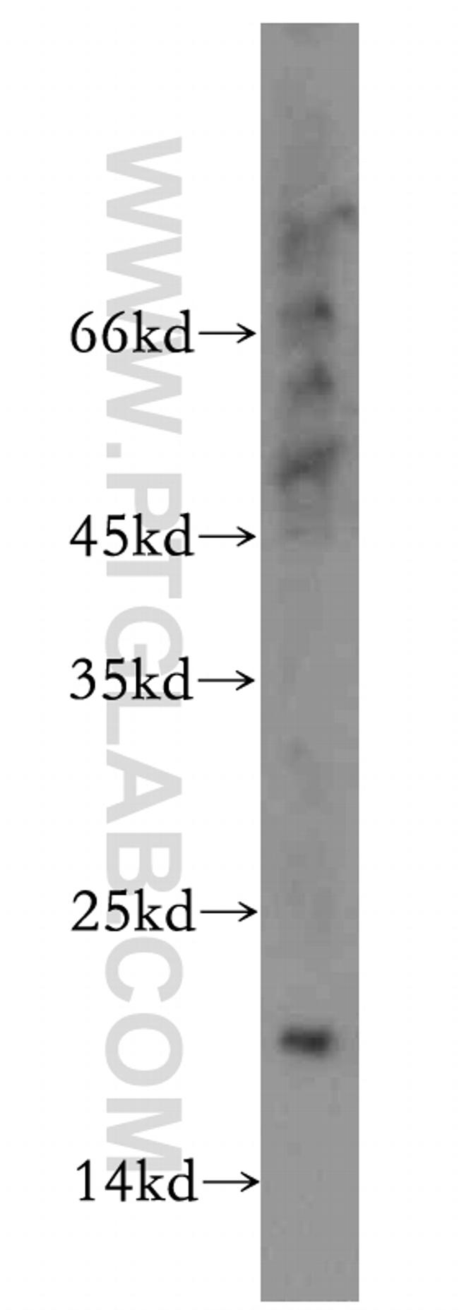 MRPL23 Antibody in Western Blot (WB)