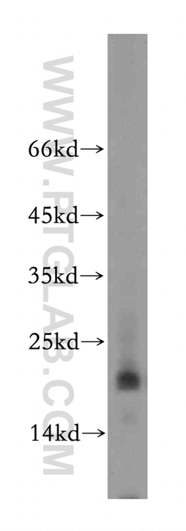 MRPL23 Antibody in Western Blot (WB)