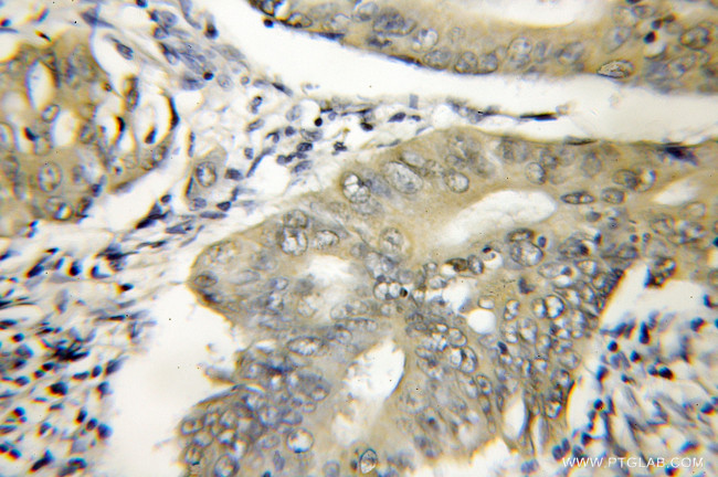 DNAJB6 Antibody in Immunohistochemistry (Paraffin) (IHC (P))