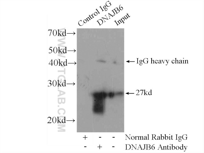 DNAJB6 Antibody in Immunoprecipitation (IP)