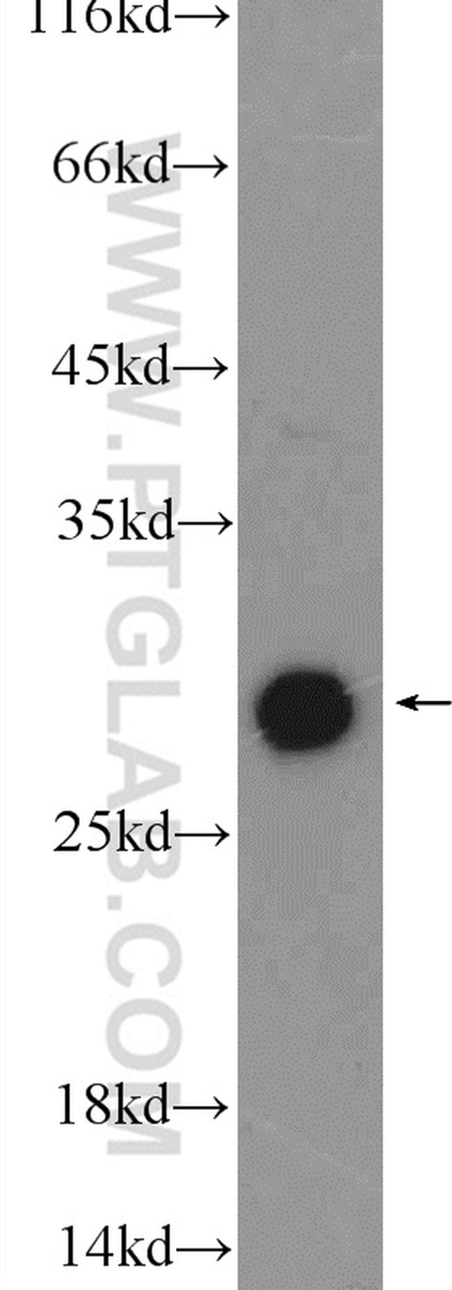 DNAJB6 Antibody in Western Blot (WB)