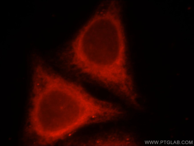 SMN Antibody in Immunocytochemistry (ICC/IF)