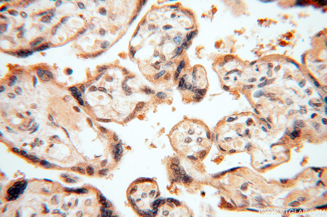 SMN Antibody in Immunohistochemistry (Paraffin) (IHC (P))