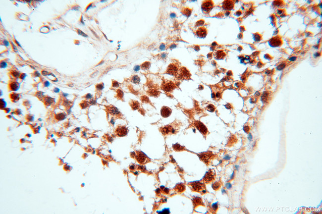 SMN Antibody in Immunohistochemistry (Paraffin) (IHC (P))