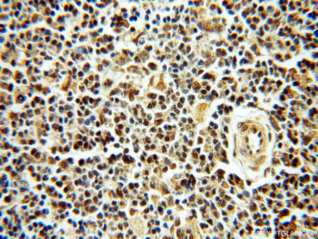 SMN Antibody in Immunohistochemistry (Paraffin) (IHC (P))