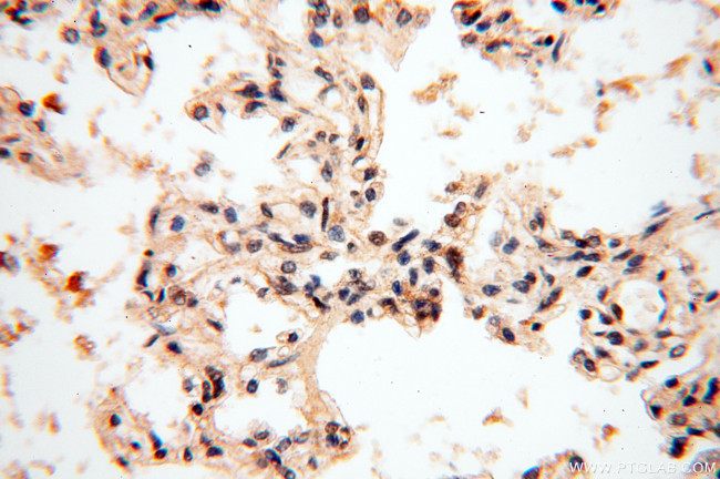 SMN Antibody in Immunohistochemistry (Paraffin) (IHC (P))