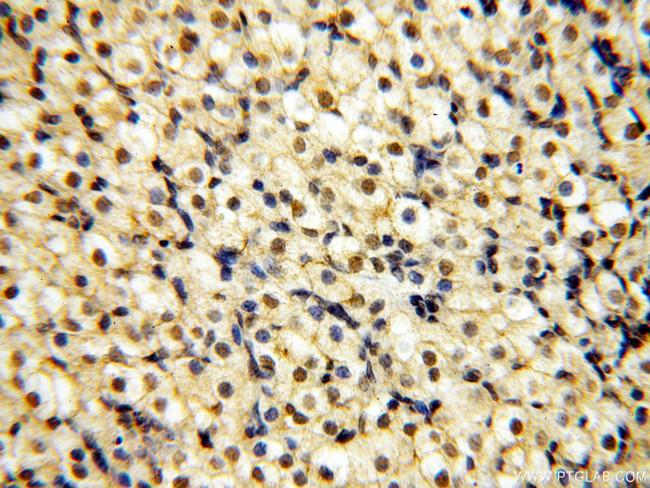 SMN Antibody in Immunohistochemistry (Paraffin) (IHC (P))