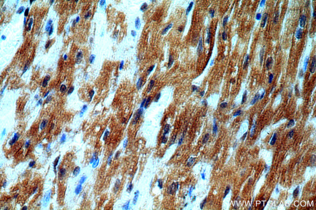 SMN Antibody in Immunohistochemistry (Paraffin) (IHC (P))