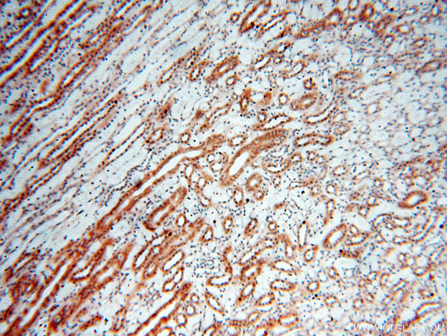 SMN Antibody in Immunohistochemistry (Paraffin) (IHC (P))