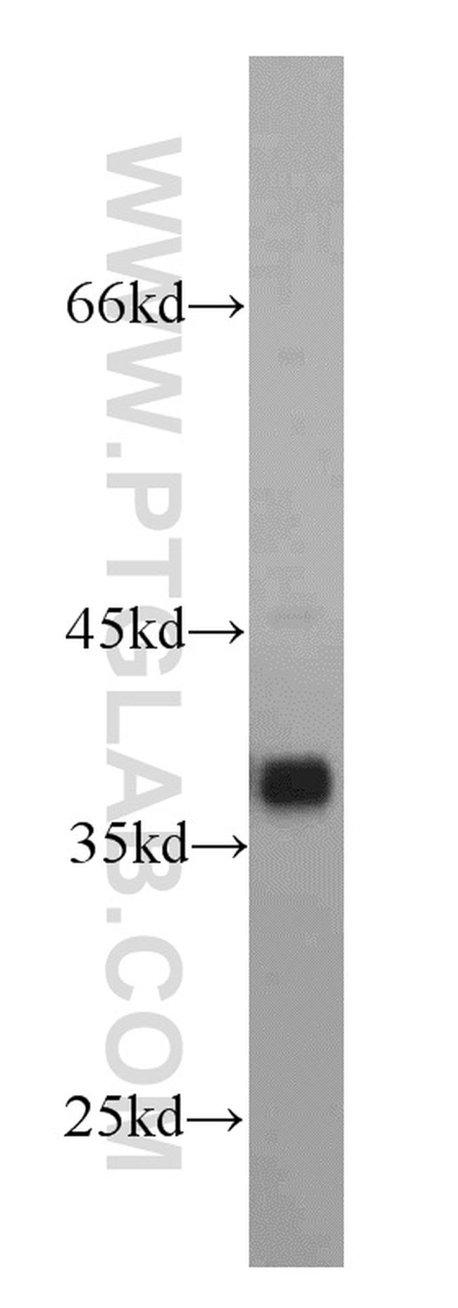 SMN Antibody in Western Blot (WB)