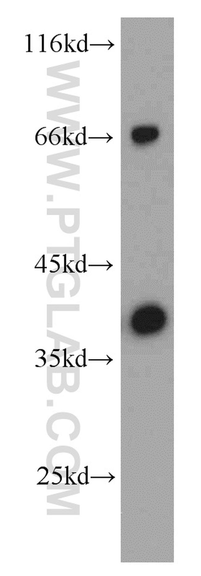 SMN Antibody in Western Blot (WB)