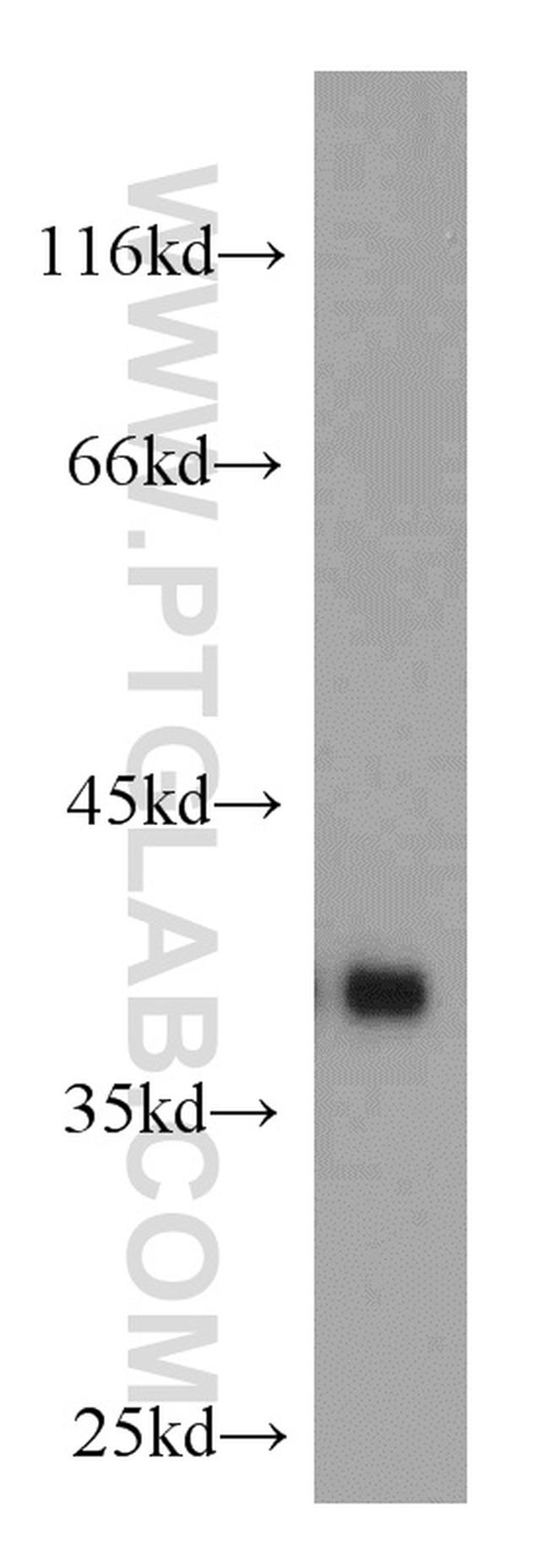 SMN Antibody in Western Blot (WB)