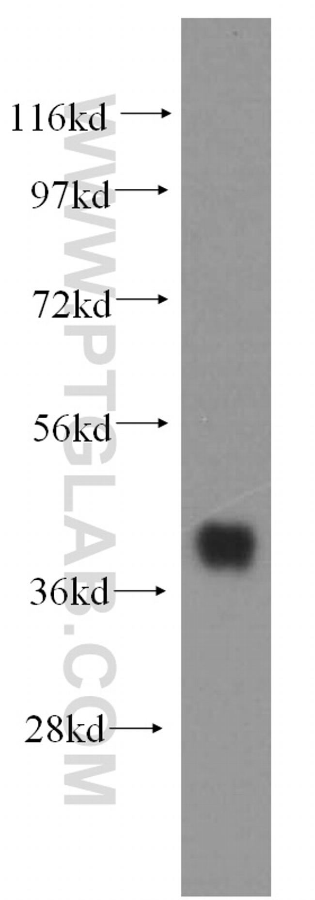 SMN Antibody in Western Blot (WB)