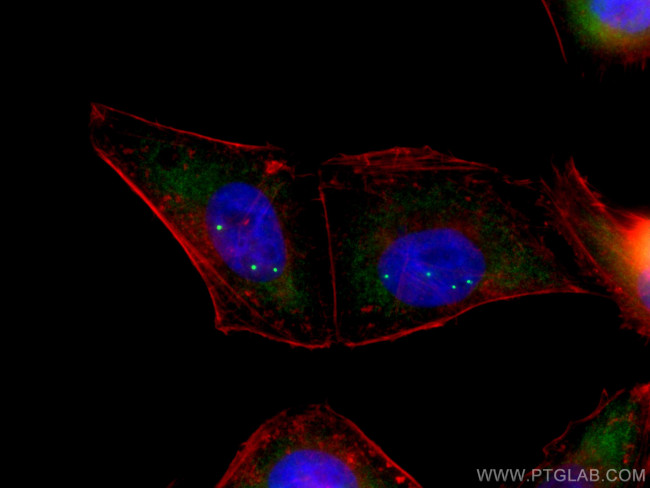 SMN Antibody in Immunocytochemistry (ICC/IF)