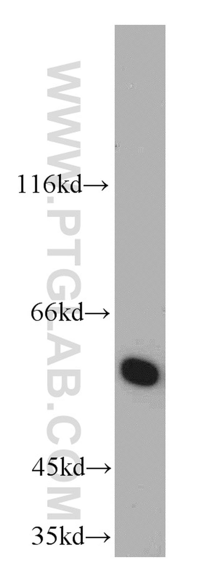 CSN1 Antibody in Western Blot (WB)