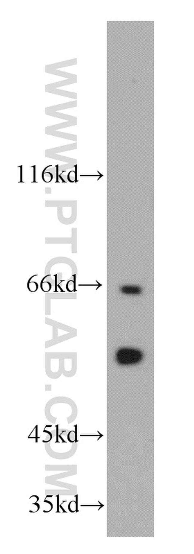 CSN1 Antibody in Western Blot (WB)