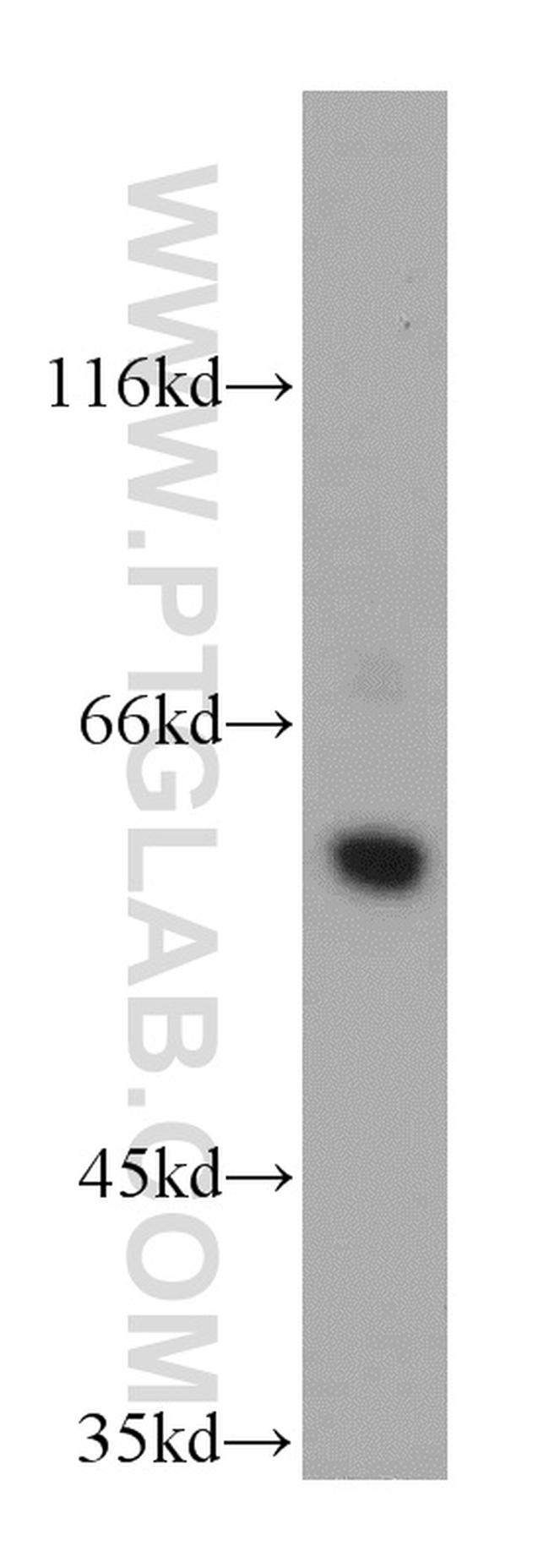 CSN1 Antibody in Western Blot (WB)