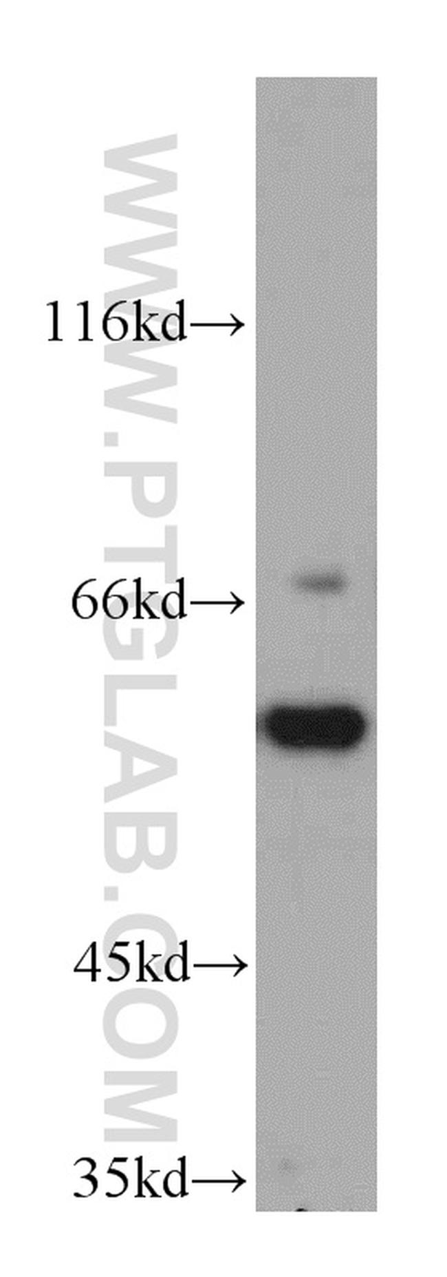 CSN1 Antibody in Western Blot (WB)