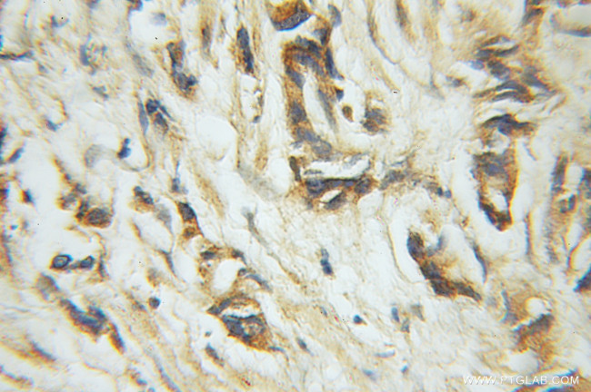 CSN1 Antibody in Immunohistochemistry (Paraffin) (IHC (P))