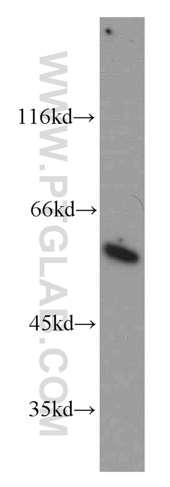 CSN1 Antibody in Western Blot (WB)