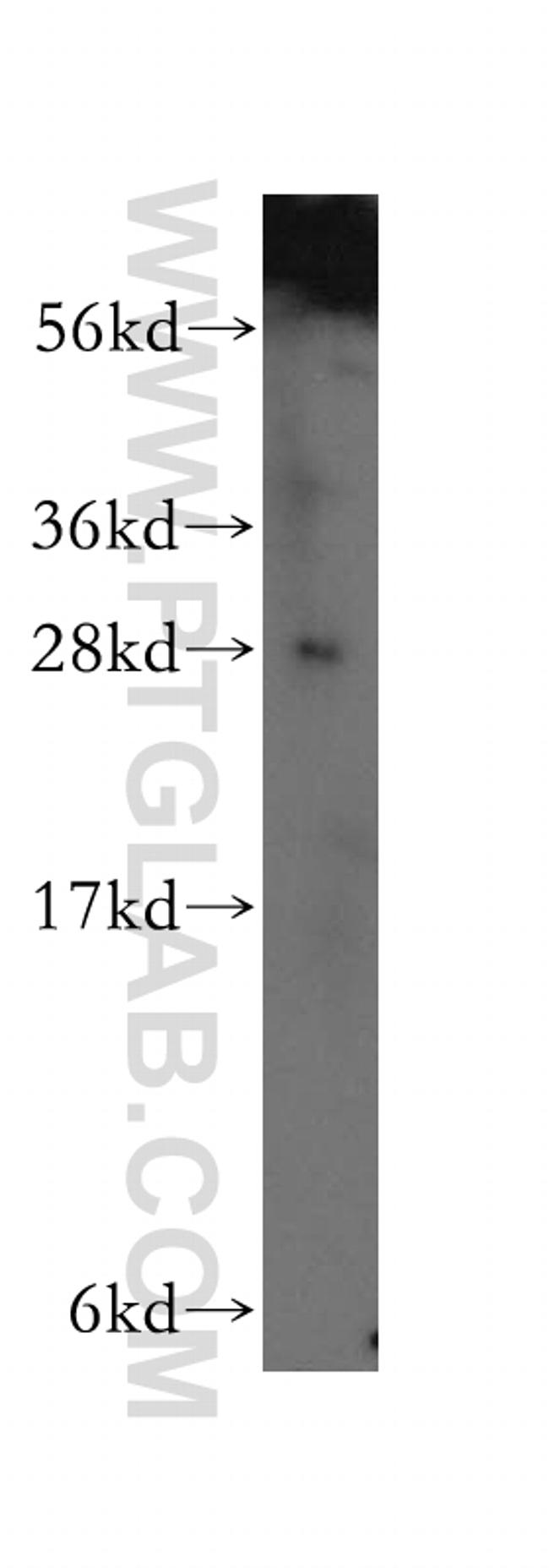 GAR1 Antibody in Western Blot (WB)