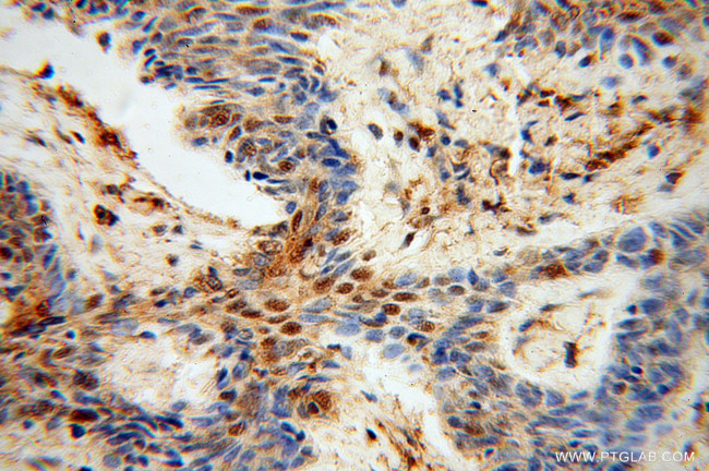 GAR1 Antibody in Immunohistochemistry (Paraffin) (IHC (P))