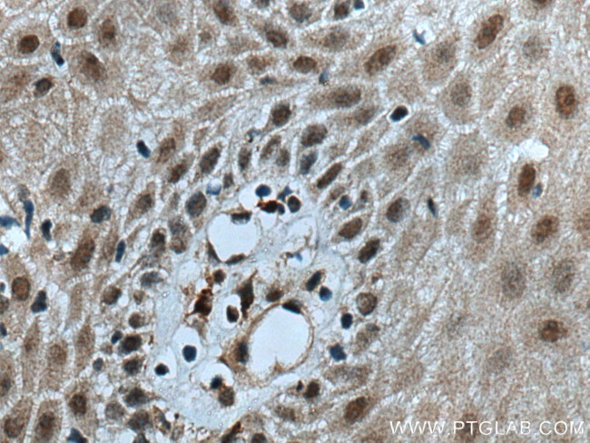 GAR1 Antibody in Immunohistochemistry (Paraffin) (IHC (P))