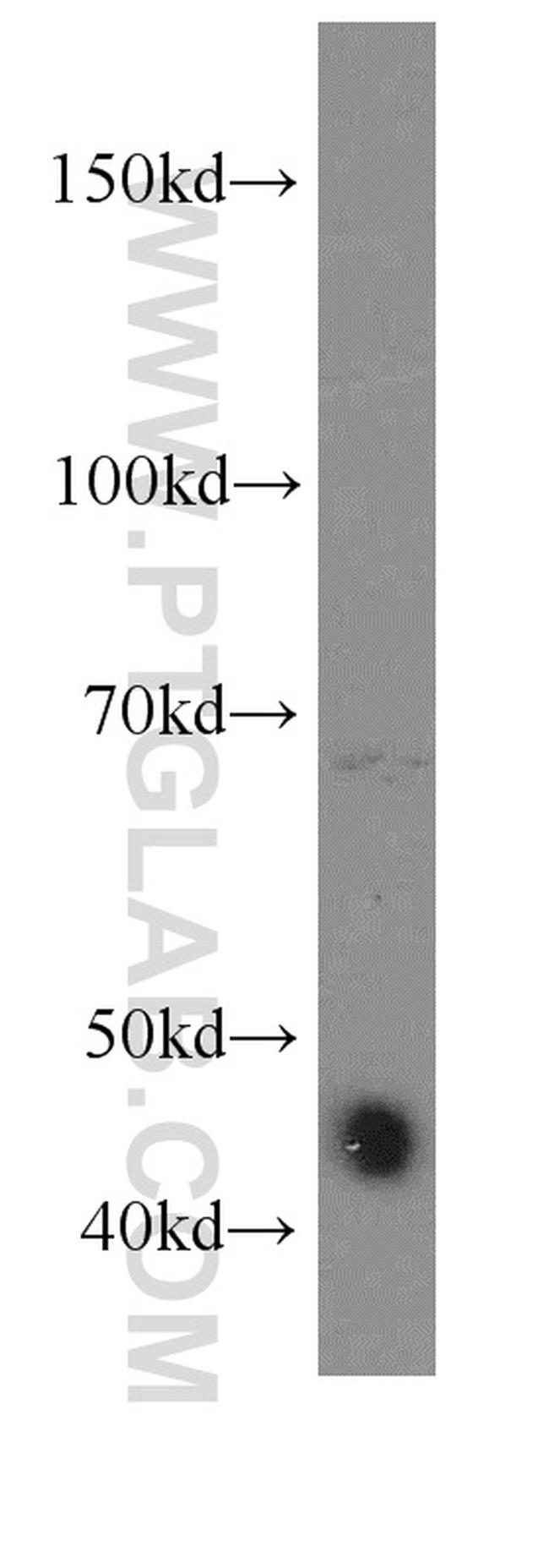 DNAJA1 Antibody in Western Blot (WB)