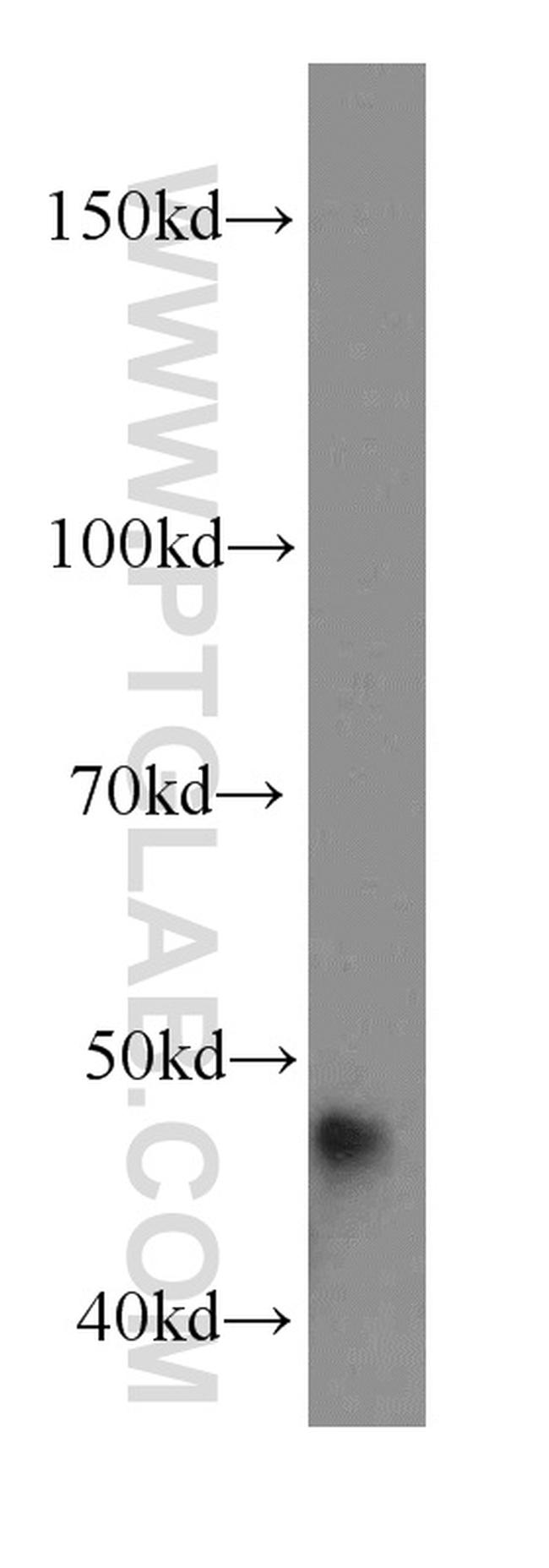 DNAJA1 Antibody in Western Blot (WB)