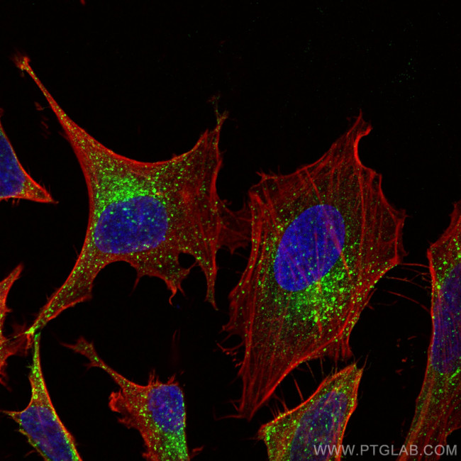 IFITM3 Antibody in Immunocytochemistry (ICC/IF)