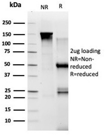 TADA1 (Transcriptional Adapter 1)/STAF42 Antibody in SDS-PAGE (SDS-PAGE)