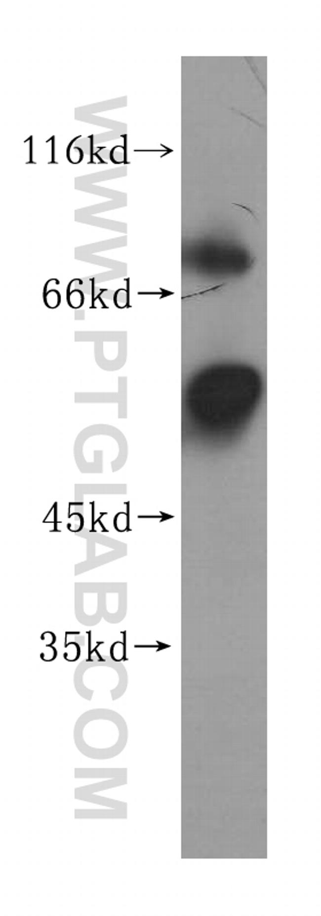 PPP5C Antibody in Western Blot (WB)