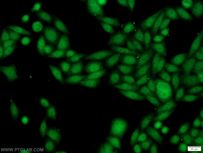 SSB Antibody in Immunocytochemistry (ICC/IF)