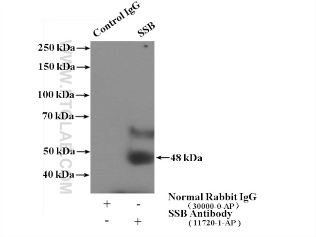 SSB Antibody in Immunoprecipitation (IP)