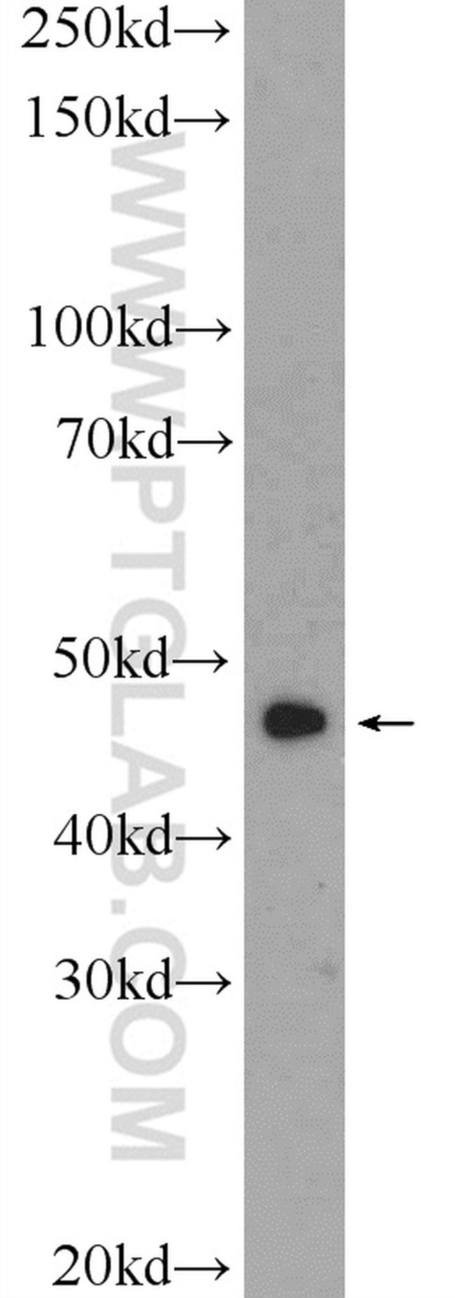 SSB Antibody in Western Blot (WB)