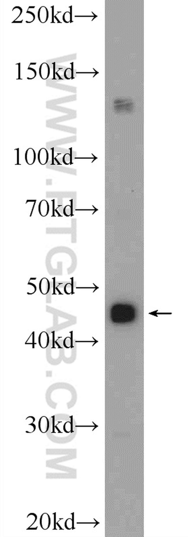 SSB Antibody in Western Blot (WB)