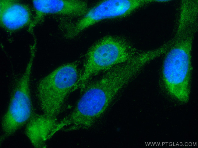 Maspin Antibody in Immunocytochemistry (ICC/IF)