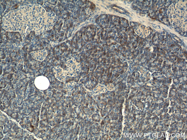 Maspin Antibody in Immunohistochemistry (Paraffin) (IHC (P))